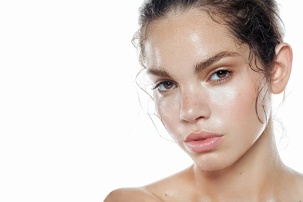 Oily skin with excess sebum and shine, highlighting formulation constraints for oily skin whitening.