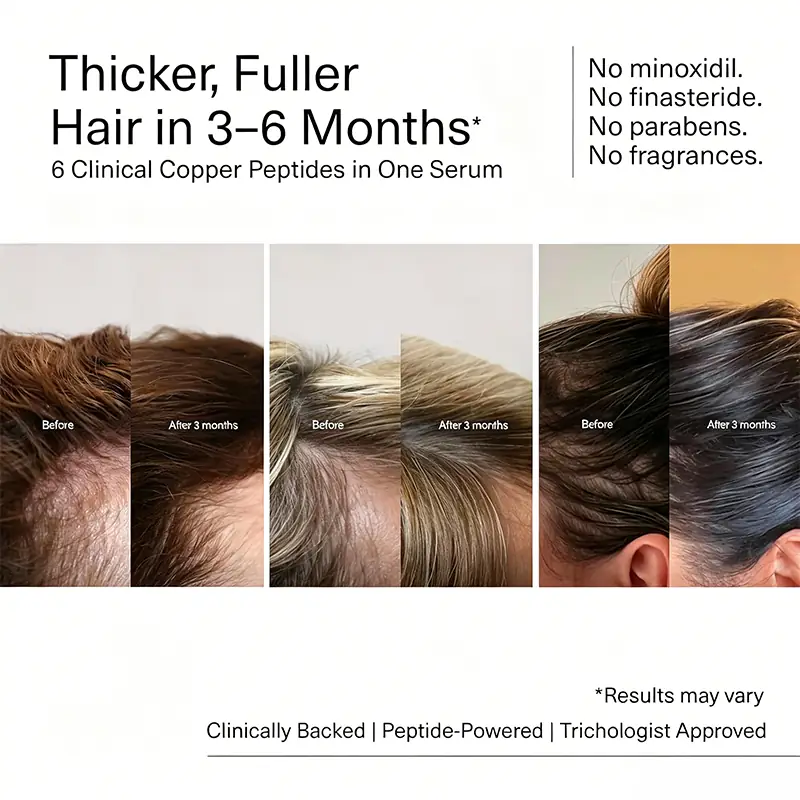 Hair growth serum before and after visual for thicker fuller hair in three to six months