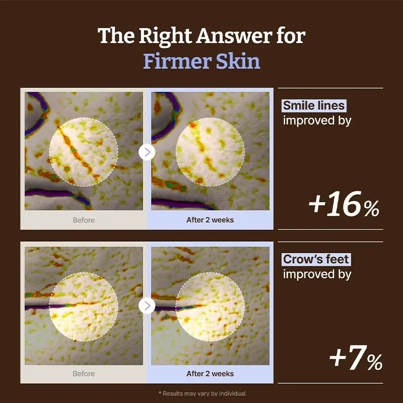 Clinical style data image showing smile lines and crow's feet improvement for PDRN copper peptide serum