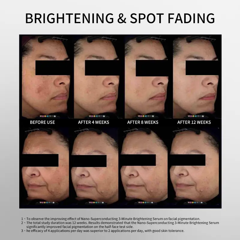 Brightening and spot fading serum test image showing improvement after 4 8 and 12 weeks