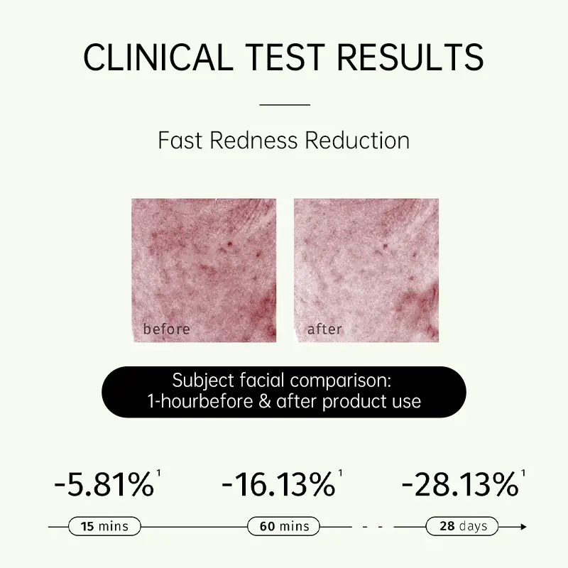 Clinical test results for fast redness reduction sensitive skin repair skincare set