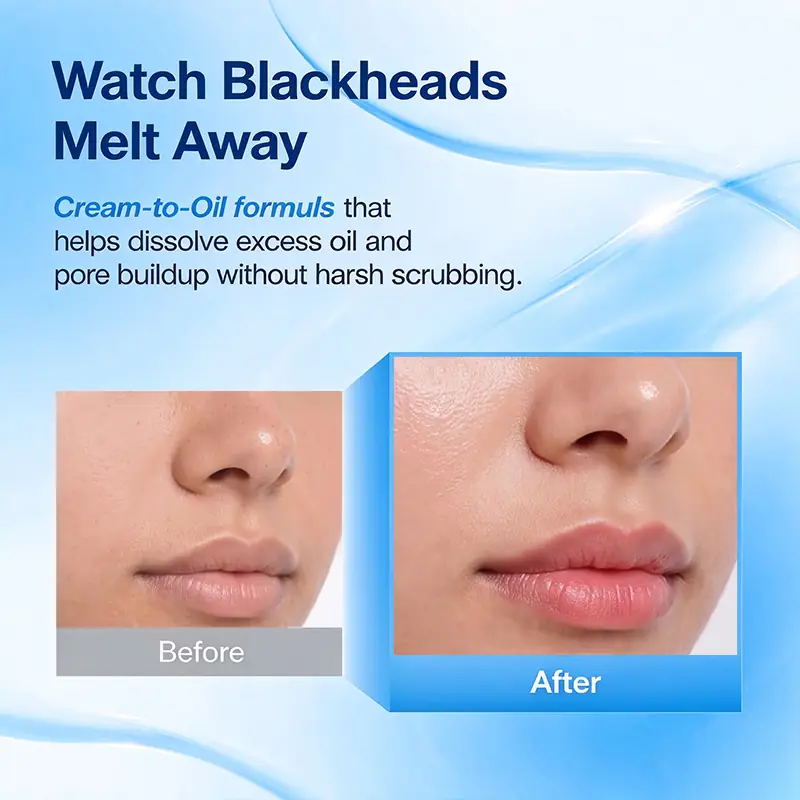 Cream-to-oil pore cleanser for blackhead-prone and congested skin