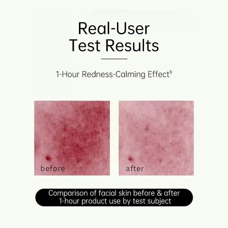 Real user test results for redness calming sensitive skin repair serum after one hour use