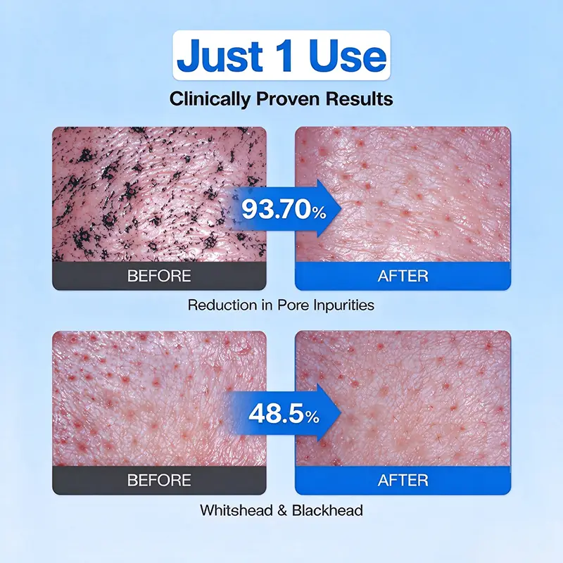 How to use cream-to-oil blackhead cleanser on dry skin