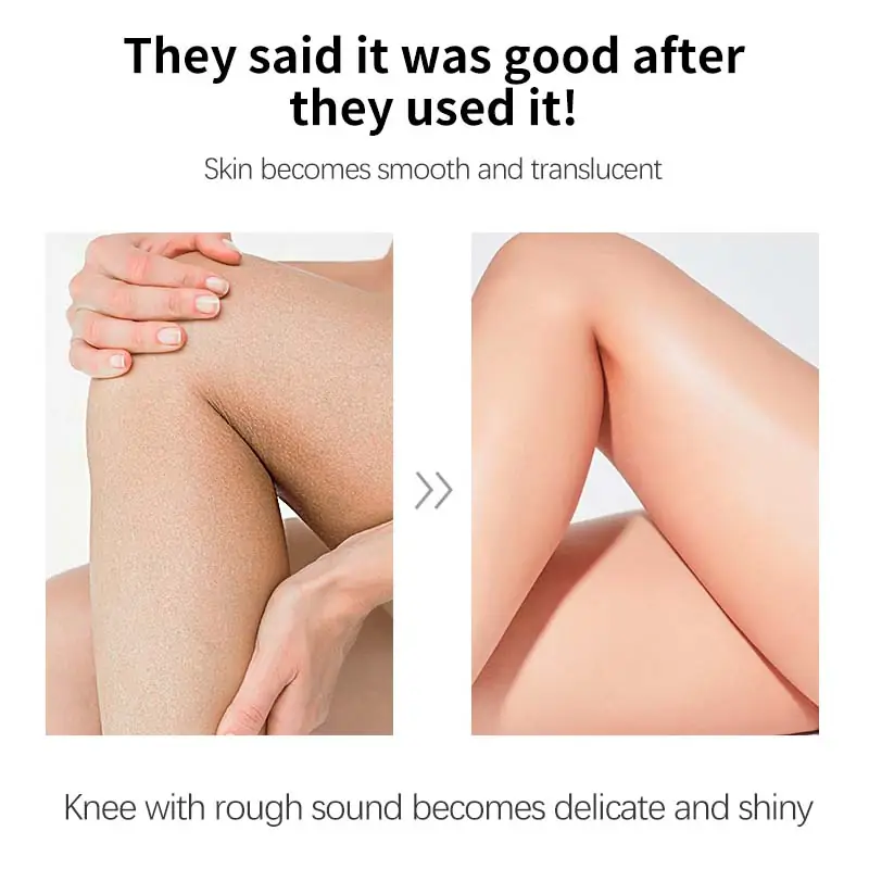 Lactic acid body lotion for rough-looking knees elbows arms and legs