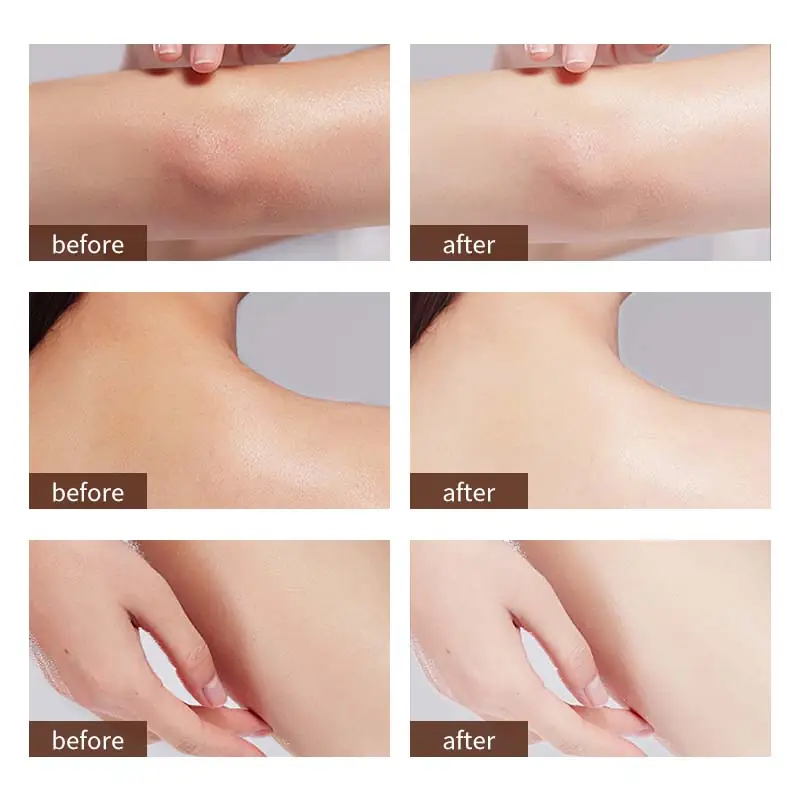 Before and after body skin texture care with lactic acid lotion
